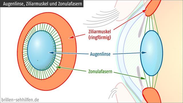 Ziliarmuskel