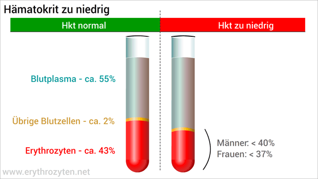 Hämatokrit erniedrigt