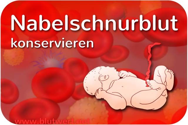 Nabelschnurblut Stammzellen
