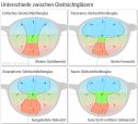 Gleitsichtbrille: Gläser-Unterschiede