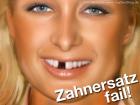 Zahnersatz