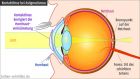 Astigmatismus Kontaktlinsen