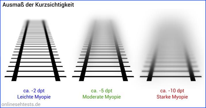 myopie astigmatismus)
