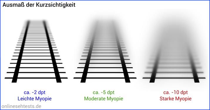 Myopie astigmatismus presbyopie - Rövidlátás – Wikipédia